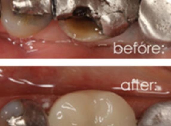 Moggill Road Dental - Taringa, QLD