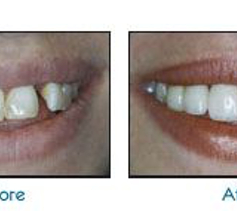 Wyse Family & Cosmetic Dentistry - Bloomington, IL