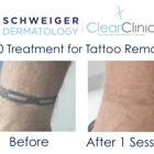 Schweiger Dermatology Group - Upper East Side