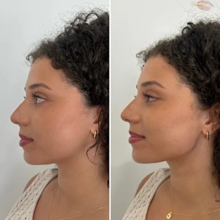 BeautyFULL Cosmetic Medical Clinic - Kingscliff, NSW