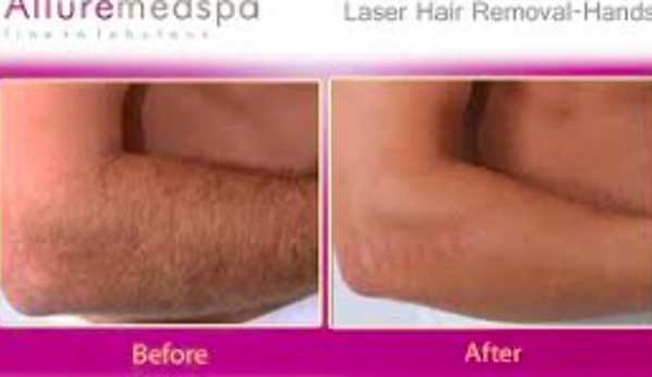 Electrolysis Hair Removal & Facial Spa by Diane - Mamaroneck, NY