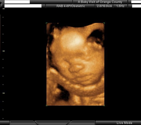 A Baby Visit 4D Ultrasound - Orange, CA