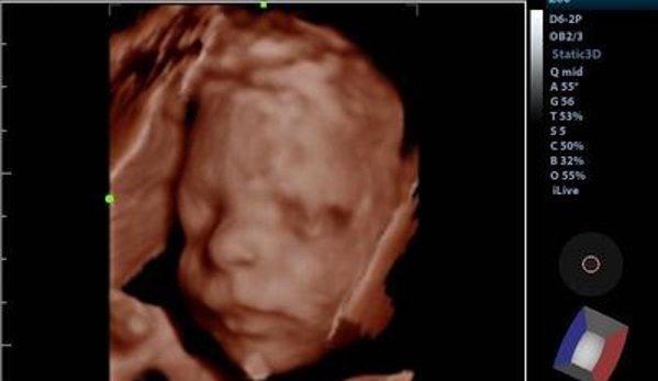 (Arlington) Baby Bee 3D Ultrasound + Studio - Arlington, TX