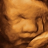 TLC Imaging 3D/4D Ultrasounds gallery