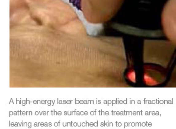 Dermatology, Laser, & Vein Specialists of the Carolinas - Charlotte, NC