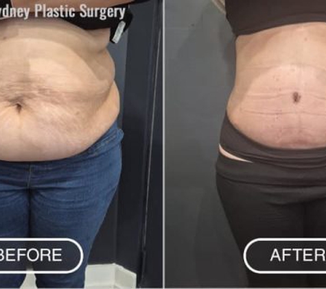 Sydney Plastic Surgery® - Dr Barnouti - Glebe, NSW