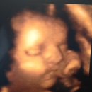 Moms-to-Be Ultrasound - Medical Imaging Services