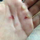 Crow Hill Crossfit - Physical Therapists