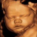 Mother Nurture 3D/4D Ultrasound - Medical Imaging Services