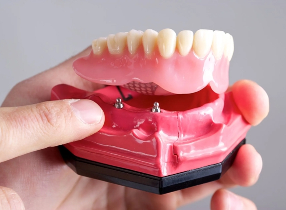 Right Dentures - Wanniassa, ACT