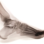 Bethlehem Podiatry: Fallon-Kline Foot and Ankle