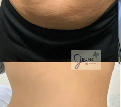 Jeune MedSpa - La Habra, CA