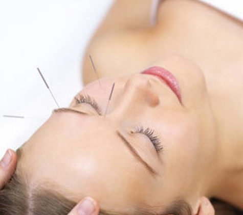 Pinebrook Acupuncture - Garden Grove, CA