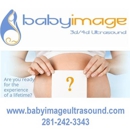 Baby Image 3d 4d Ultrasound - Medical Imaging Services