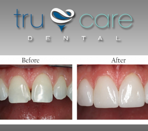 Tru Care Dental - Albuquerque, NM