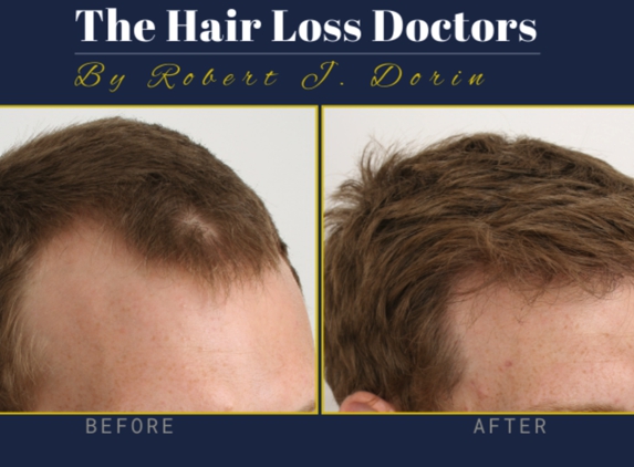 The Hair Loss Doctors - Garden City, NY