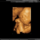 A Baby Visit 4D Ultrasound
