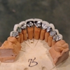 Echo Dental Lab gallery