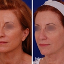 Visage Facial Plastic Surgery - Physicians & Surgeons, Cosmetic Surgery