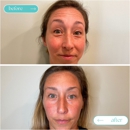 Prana Med Spa - Medical Spas
