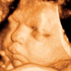 Clear Image 4D Ultrasound : Brooklyn
