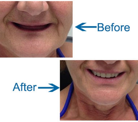 Cronulla Denture Care