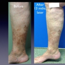 Scarless Vein Care by Dr. Kamran - Wilmington - Health & Welfare Clinics