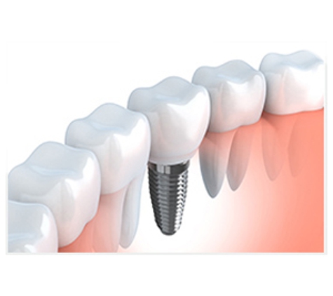 Queanbeyan Denture Clinic - QDC - Queanbeyan, NSW