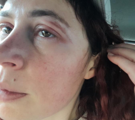 Essential Beauty & Piercing Tea Tree Plaza - Modbury, SA. Can can't see out of my eye now!! Your scum