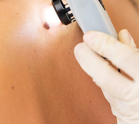 Nashville Dermatology And Skin Cancer Clinic - Nashville, TN