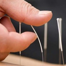 Springer Acupuncture - Acupuncture
