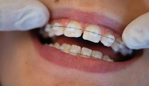 Orthodontix Northbridge - Northbridge, NSW