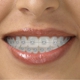 iCare Dental