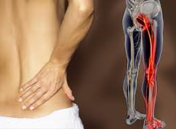 OFP Pty Ltd t-as Orion Family Physiotherapy - Springfield Central, QLD. Treatment of SCIATICA AND NERVE CONDITIONS