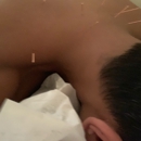 Dr Chen Acupuncture - Acupuncture