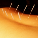 Classical Herbs and Acupuncture - Acupuncture