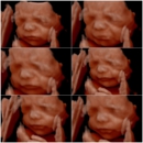 Hello Baby! 4D Ultrasound Studio - Pregnancy Information & Services