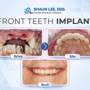 Shaun Lee DDS: Dental Implant and General Dentistry of Auburn