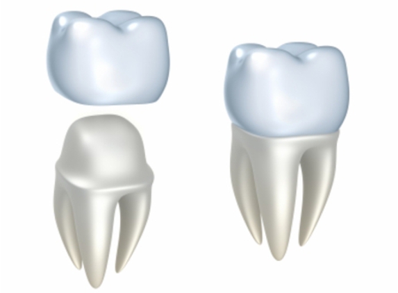 Yamanto Dental Surgery - Yamanto, QLD