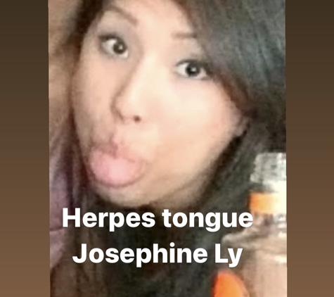 Natural Weightloss - Los Angeles, CA. #josiethedyke #josiegrosie #sepreh #Horsenose #fishmouthhd #herpesduong