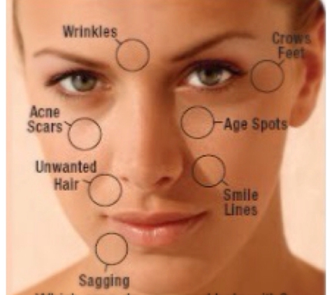 Cosmetic Laser Solutions MedSpa - MA & RI - Wilmington, MA