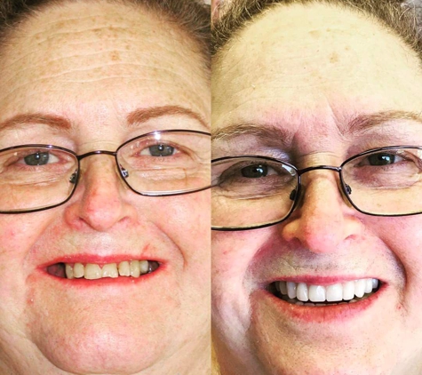 David W Epstein DDS, Inc - Novato, CA. Before and after