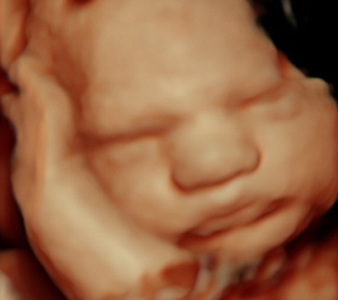 A New Conception 3D Ultrasound Studio - Hanover, MA. 30 weeks baby in HDlive Ultrasound.  See the difference!