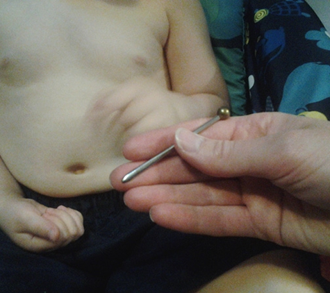 Queanbeyan Acupuncture - Queanbeyan, NSW