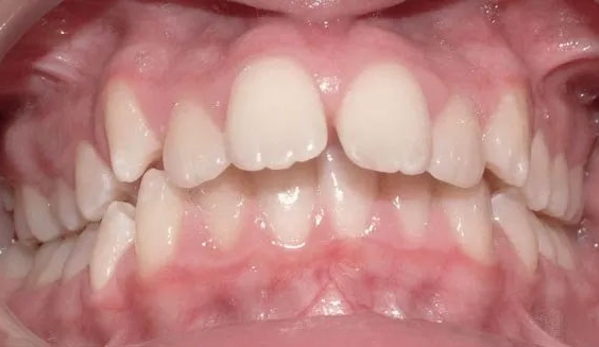 E Orthodontics - Doncaster East, VIC
