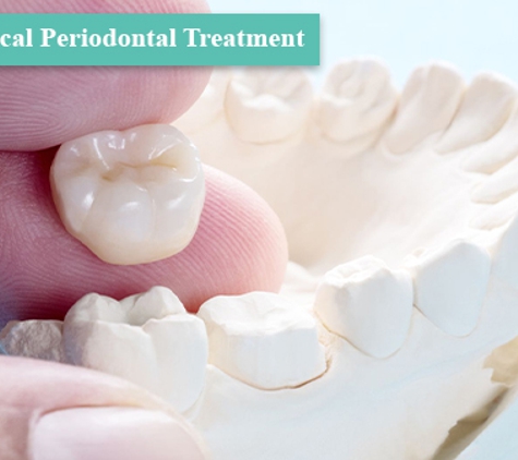 Perio Health Specialists - Dandenong, VIC. Non-Surgical Periodontal Treatment