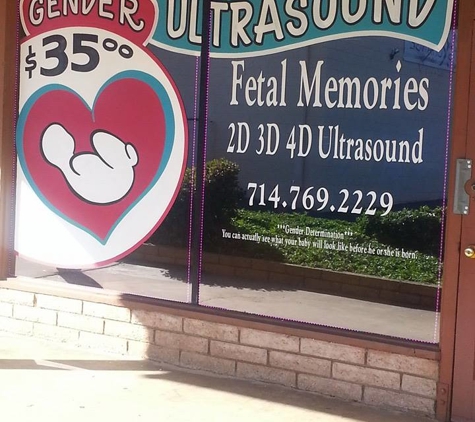 Fetal Memories 2D 3D 4D Ultrasound - Orange, CA