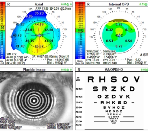 Image Eye Care - Tyler, TX