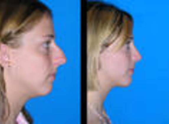 Clymer Facial Plastic Surgery - Brentwood, TN