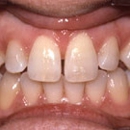 Dental Office Socal Smiles - Dental Hygienists